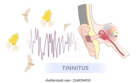 Concepto médico para zumbido de sonido en el oído con anatomía de corte transversal