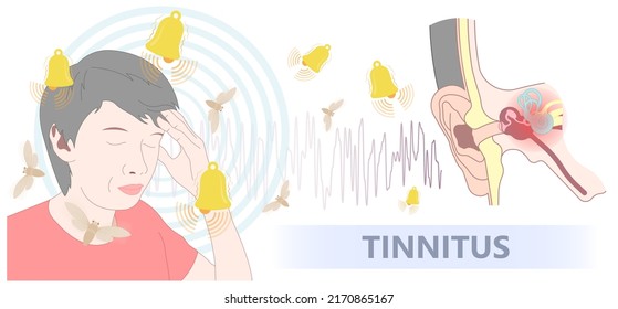 Tinnitus disorder a ringing sound in the ear hearing loss wave level anxiety test assist exam inner exposure problem circulatory nerves hair cell canal Earwax