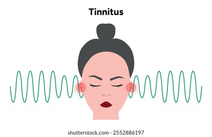 Ruido de tinnitus en el oído humano zumbido y mareos enfermedad