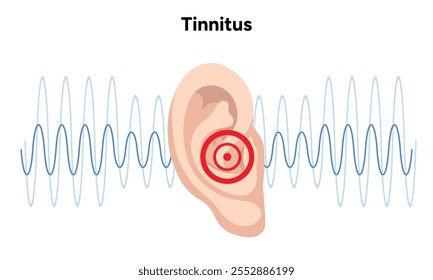 Ruido de tinnitus en el oído humano zumbido y mareos enfermedad