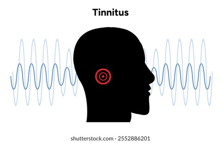 Ruido de tinnitus en el oído humano zumbido y mareos enfermedad