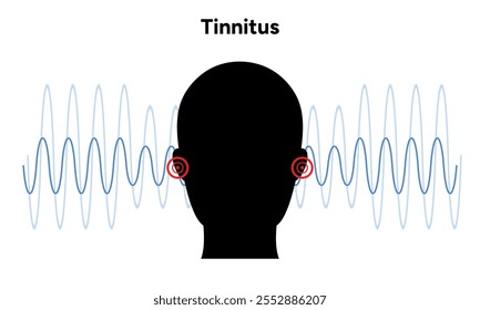 Ruido de tinnitus en el oído humano zumbido y mareos enfermedad