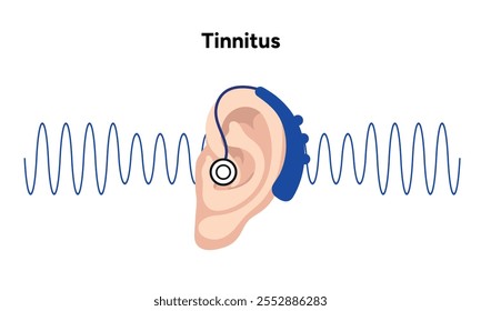 Ruido de tinnitus en el zumbido del oído humano y mareos con audífonos