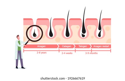 Tiny Doctor Character With Huge Magnifying Glass At Medicine Infographics Representing Hair Growth And Loss Cycles. Anagen, Catagen, Telogen And Anagen Restart. Cartoon People Vector Illustration