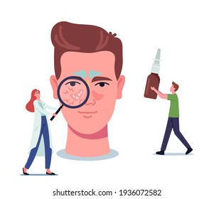 Tiny Doctor Female Character with Magnifier Representing Sinusitis Disease on Huge Male Head, Man Bring Remedy for Nose Treatment. Respiratory Sickness Anatomy. Cartoon People Vector Illustration