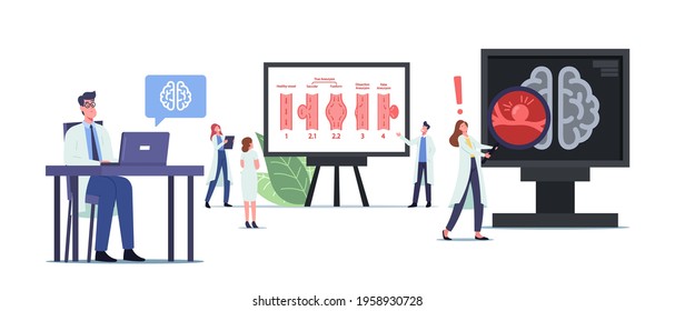 Tiny Doctors Characters at Huge Infographics with Aneurysm Phases. Disease of Artery Wall Weakening That Create Bulge, Distention of Artery, Brain Stroke, Apoplexy. Cartoon People Vector Illustration