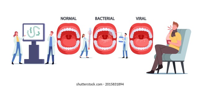 Tiny Doctors Characters Presenting Infographics with Normal, Bacterial and Viral Pharyngitis or Tonsil in Throat. Streptococcus Thermophilus Bacteria Infection. Cartoon People Vector Illustration