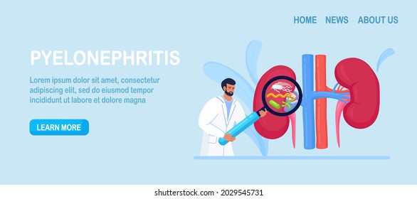 Pequeños Médicos Nefroólogos Diagnosticando Enfermedad de Pielonefritis. Diagnóstico Hospitalario, Tratamiento del Riñón. Médico con vidrio de aumento. Urología y Nefrología, Nefrotosis, Insuficiencia Renal, Cistitis