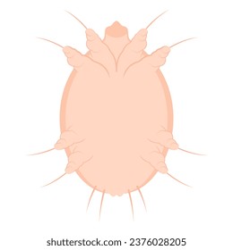 Tiny mites called Sarcoptes scabiei infected Hand and wrist the dermis skin inflammation with red itching caused by scabies in medical