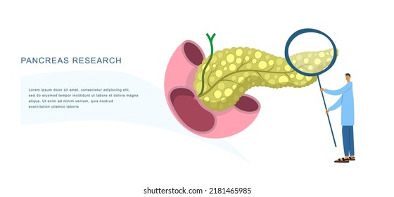 Tiny Physician Examines Human Pancreas With Magnifier To Diagnose Its Diseases. Medical Observation Flat Vector Banner For Diagnostic Center, Laboratory, Clinic, Research Institution, Conference Etc. 