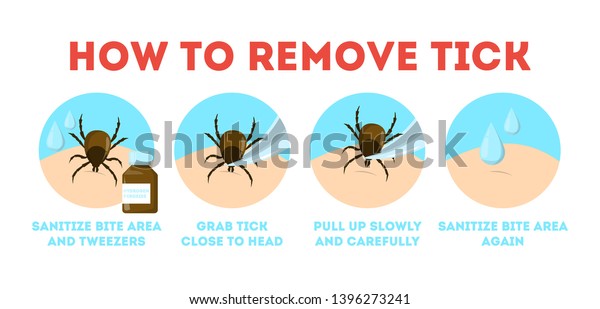 Tips Tick Safety Infographic How Remove 库存矢量图（免版税）1396273241 | Shutterstock