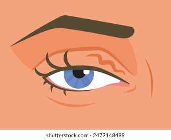 
Tired Eye Twitching with Health problems Vector Illustration. Person suffering from blepharospasm showing symptoms 
