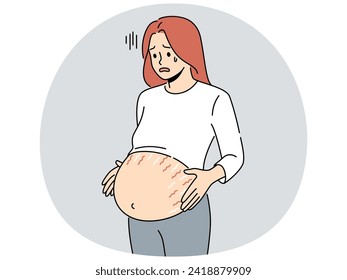 Tired pregnant woman with huge belly with stretch marks on last months of pregnancy. Exhausted unwell future mother awaiting childbirth. Vector illustration.