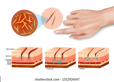 Tissue Injury And Inflammation. Cell Injury Inflammation And Repair. Immune System