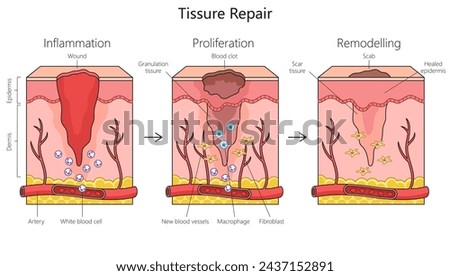 Tissue repair structure diagram hand drawn schematic vector illustration. Medical science educational illustration
