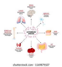 Tissues of the human body affected by autoimmune attack. Vector diagram for your design, educational, medical, biological and science use