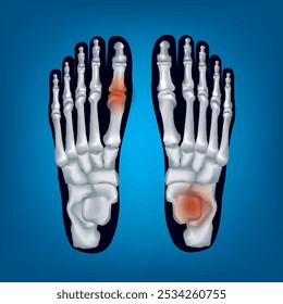 Toe Bone.Foot bone structure. Human leg anatomy illustration isolated on blue background.