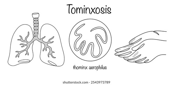 Tominxose. Helmintíase, caracterizada por lesão do trato respiratório. Um verme desenhado que infecta o trato respiratório humano devido às mãos contaminadas com helmintos. 