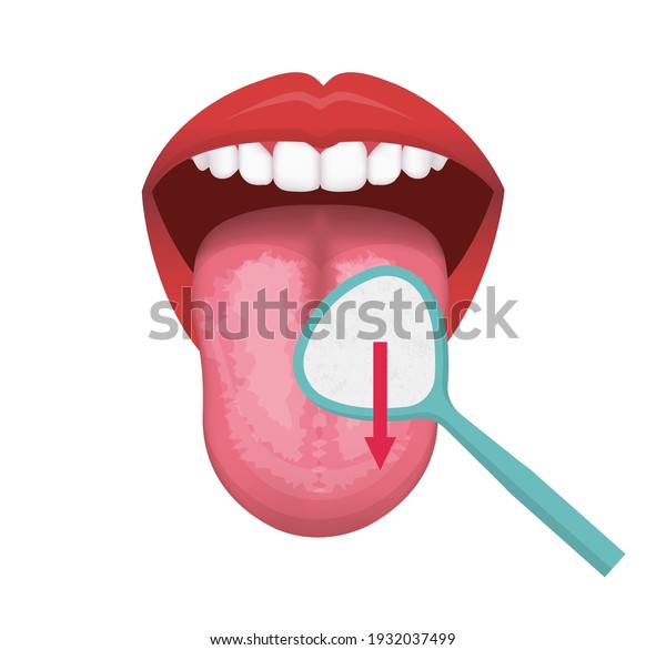 The Biochemistry of Halitosis: How VSCs Create Malodor
