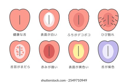 Conjunto de ilustración de tipo de Estado de salud de la lengua: lengua saludable, superficie blanca, bordes desiguales, grietas, recubrimiento de lengua moteada, enrojecimiento fuerte, superficie amarilla, lengua púrpura