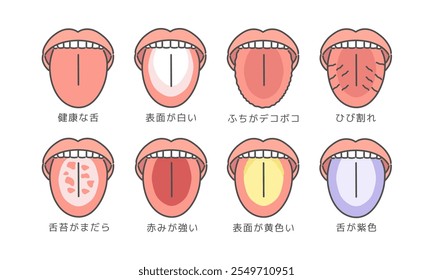 Conjunto de ilustración de tipo de Estado de salud de la lengua: lengua saludable, superficie blanca, bordes desiguales, grietas, recubrimiento de lengua moteada, enrojecimiento fuerte, superficie amarilla, lengua púrpura