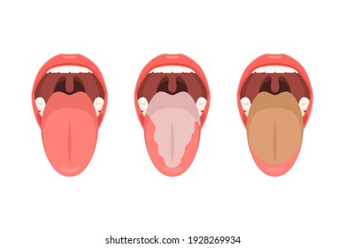 Tongue with plaque and clean tongue. Tongue hygiene concept. Vector illustration isolated on white background