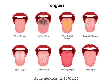 Tongue problems, wavy, cracked, strawberry, geographic, yellow, hairy black and white tongues