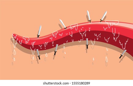 Tongue is stuck by swords. The meaning of swords facing up is the the danger of the tongue that can produce bad words to people. While swords at the bottom means that reciprocity to hurt itself.