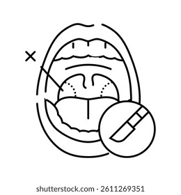 tonsillectomy surgery line icon vector. tonsillectomy surgery sign. isolated contour symbol black illustration