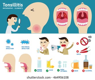 Tonsillitis Infographic Element.
Flat Vector Cartoon Design Illustration.
Health Care Concept. 