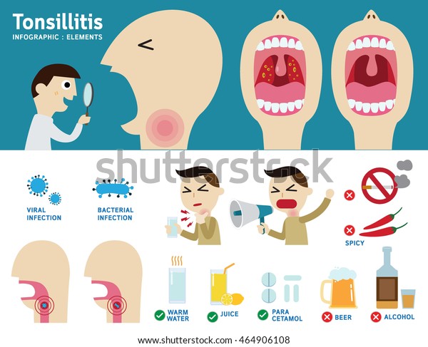 Tonsillitis Infographic Element Flat Vector Cartoon Stock Vector ...