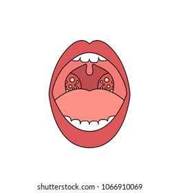 tonsillitis vector icon