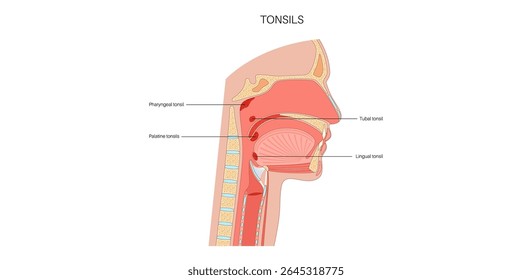 Tonsils anatomical medical poster. Oval shaped masses of lymphoid tissue located at the back of the human throat. Traps germs entering through the mouth or nose medical flat vector illustration.