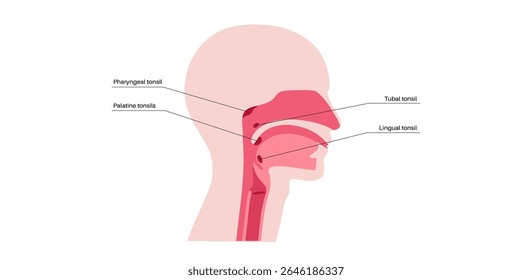 Cartaz médico anatômico de amídalas. Massas ovais de tecido linfoide localizadas na parte posterior da garganta humana. Armadilhas germes que entram pela boca ou nariz ilustração de vetor plana médica.