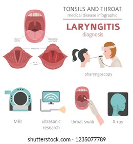 Tonsils Throat Diseases Laryngitis Symptoms Treatment Stock Vector ...