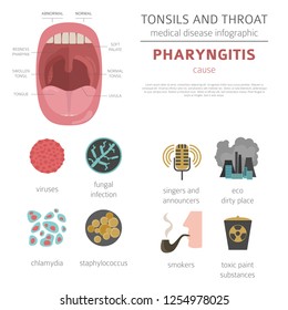 Tonsils and throat diseases. Pharyngitis symptoms, treatment icon set. Medical infographic design. Vector illustration