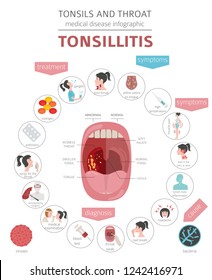 10,773 Tonsillitis Images, Stock Photos & Vectors | Shutterstock