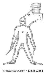 It is a tool used to apply cold or hot fluid throughout the patient's body, vintage line drawing or engraving illustration.