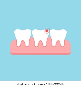 Tooth with ache pain and healthy in gum isolated on blue background. Sick human teeth, dent hygiene, prevention treatment concept. Flat design cartoon style vector dental illustration.