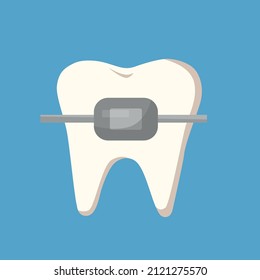 Tooth alignment with braces. Orthodontic treatment. Vector cartoon.