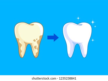 Tooth before and after. Yellow becomes white, Dental care concept,  illustration isolated on blue background.