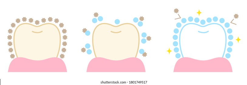 blanqueamiento dental antes de la ilustración posterior. aislado de fondo blanco. concepto odontológico cosmético