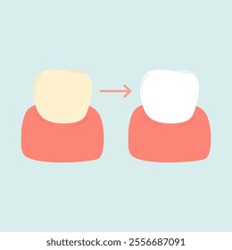 Tooth Bleaching and Whitening Illustration