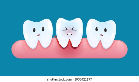 Tooth Is Bleeding In The Gum. Blood Teeth. Vector Cartoon Style.