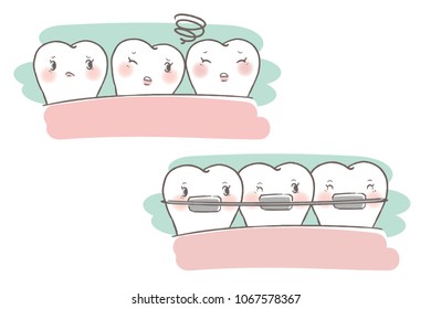 tooth with brace concept on the white background
