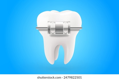 Tooth with braces. 3d vector illustration