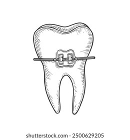 Tooth with Braces, Hand-Drawn Vector, Graphic Style, Cartoon Illustration, Black and White, Sketch Style, Isolated on White Background