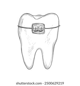 Tooth with Braces, Hand-Drawn Vector, Graphic Style, Cartoon Illustration, Black and White, Sketch Style, Isolated on White Background