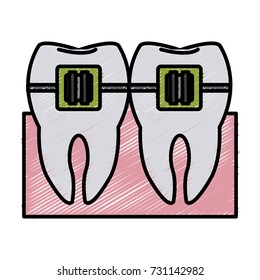 Tooth with bracket