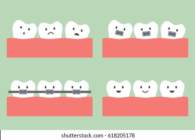 tooth cartoon vector, dental orthodontics treatment with teeth braces